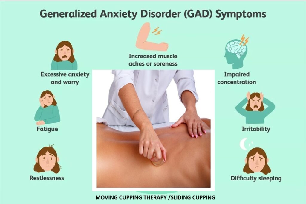 Therapist performing Myofascial Gliding Cupping Therapy
