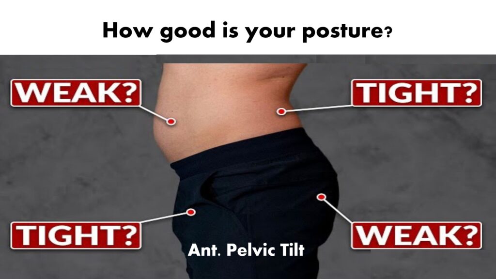 flat-feet-causing-anterior pelvic tilt -that leads to back-pain-infographic.jpg